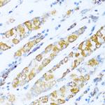 NDUFA5 Antibody in Immunohistochemistry (Paraffin) (IHC (P))