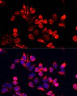 NFE2L1 Antibody in Immunocytochemistry (ICC/IF)