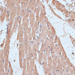 NFE2L1 Antibody in Immunohistochemistry (Paraffin) (IHC (P))