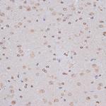 NFE2L1 Antibody in Immunohistochemistry (Paraffin) (IHC (P))