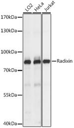 Radixin Antibody in Western Blot (WB)