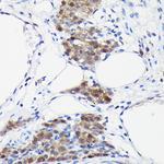 S100P Antibody in Immunohistochemistry (Paraffin) (IHC (P))