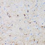 S100P Antibody in Immunohistochemistry (Paraffin) (IHC (P))