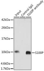 S100P Antibody in Immunoprecipitation (IP)