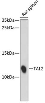 TAL2 Antibody in Western Blot (WB)