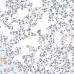 Thioredoxin 1 Antibody in Immunohistochemistry (Paraffin) (IHC (P))