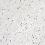 Thioredoxin 1 Antibody in Immunohistochemistry (Paraffin) (IHC (P))