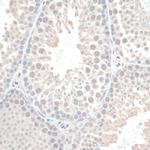 Thioredoxin 1 Antibody in Immunohistochemistry (Paraffin) (IHC (P))