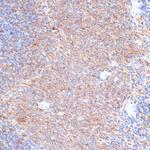 G3BP1 Antibody in Immunohistochemistry (Paraffin) (IHC (P))