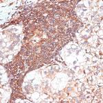 G3BP1 Antibody in Immunohistochemistry (Paraffin) (IHC (P))