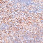 G3BP1 Antibody in Immunohistochemistry (Paraffin) (IHC (P))