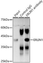 ERLIN1 Antibody in Immunoprecipitation (IP)