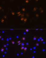 SWAP70 Antibody in Immunocytochemistry (ICC/IF)