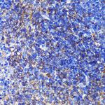 SWAP70 Antibody in Immunohistochemistry (Paraffin) (IHC (P))