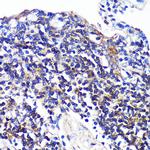 SWAP70 Antibody in Immunohistochemistry (Paraffin) (IHC (P))