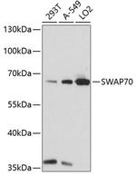 SWAP70 Antibody in Western Blot (WB)