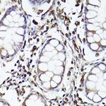 TLR8 Antibody in Immunohistochemistry (Paraffin) (IHC (P))