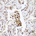 TLR8 Antibody in Immunohistochemistry (Paraffin) (IHC (P))