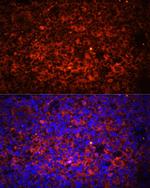 TLR8 Antibody in Immunohistochemistry (Paraffin) (IHC (P))