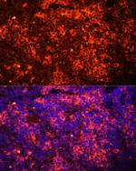 TLR8 Antibody in Immunohistochemistry (Paraffin) (IHC (P))