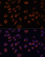 C1orf57 Antibody in Immunocytochemistry (ICC/IF)