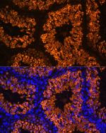 LDHC Antibody in Immunohistochemistry (Paraffin) (IHC (P))