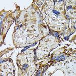 ZIPK Antibody in Immunohistochemistry (Paraffin) (IHC (P))