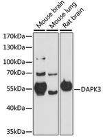 ZIPK Antibody in Western Blot (WB)