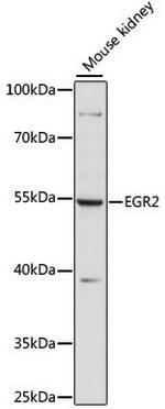 EGR2 Antibody in Western Blot (WB)