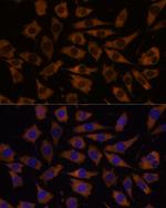 eIF5B Antibody in Immunocytochemistry (ICC/IF)