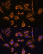 eIF5B Antibody in Immunocytochemistry (ICC/IF)