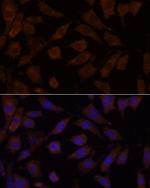 OXSR1 Antibody in Immunocytochemistry (ICC/IF)