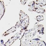 HDAC9 Antibody in Immunohistochemistry (Paraffin) (IHC (P))