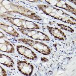 HDAC9 Antibody in Immunohistochemistry (Paraffin) (IHC (P))