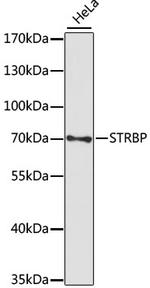 STRBP Antibody in Western Blot (WB)