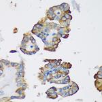 DYNLRB1 Antibody in Immunohistochemistry (Paraffin) (IHC (P))