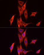 Caspase 7 p11 Antibody in Immunocytochemistry (ICC/IF)