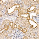 Caspase 7 p11 Antibody in Immunohistochemistry (Paraffin) (IHC (P))