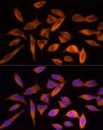 ATP Citrate Lyase Antibody in Immunocytochemistry (ICC/IF)