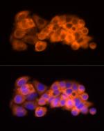 ATP Citrate Lyase Antibody in Immunocytochemistry (ICC/IF)