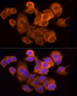 ATP Citrate Lyase Antibody in Immunocytochemistry (ICC/IF)