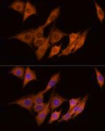 ATP Citrate Lyase Antibody in Immunocytochemistry (ICC/IF)