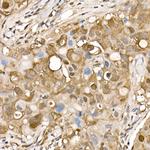 ATP Citrate Lyase Antibody in Immunohistochemistry (Paraffin) (IHC (P))