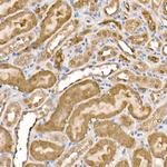 ATP Citrate Lyase Antibody in Immunohistochemistry (Paraffin) (IHC (P))