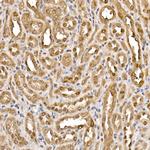 ATP Citrate Lyase Antibody in Immunohistochemistry (Paraffin) (IHC (P))