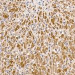 ATP Citrate Lyase Antibody in Immunohistochemistry (Paraffin) (IHC (P))