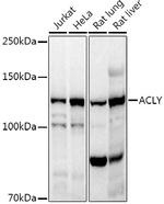 ATP Citrate Lyase Antibody in Western Blot (WB)