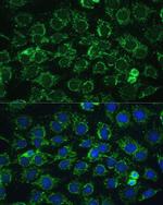 ATP Synthase gamma Antibody in Immunocytochemistry (ICC/IF)