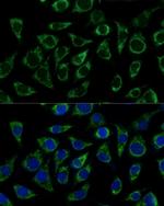 ATP Synthase gamma Antibody in Immunocytochemistry (ICC/IF)