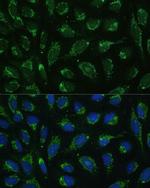 ATP Synthase gamma Antibody in Immunocytochemistry (ICC/IF)